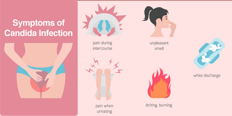 Yeast Infection Vs Herpes Understanding The Differences In 2023